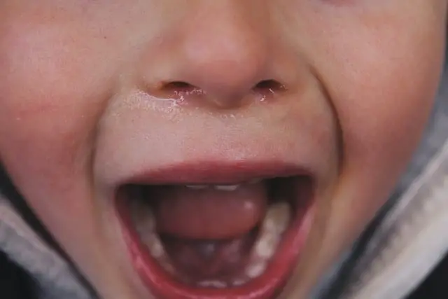 Kind mit offenem Mund